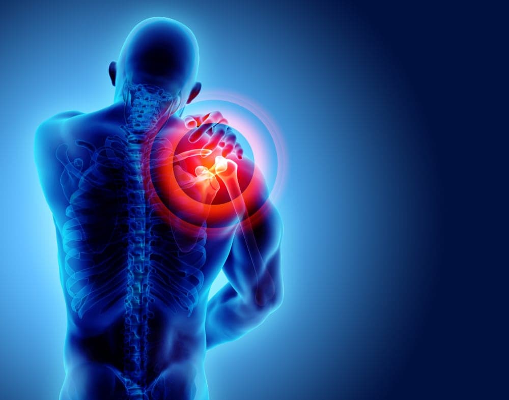 Rotator cuffs injury